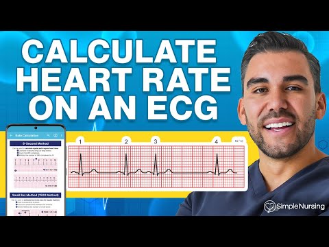 How to Calculate Heart Rate on ECG: Easy Steps to Master Pulse Counting