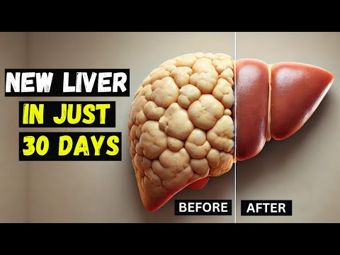 How I Reversed LIVER DAMAGE in Just 30 Days.