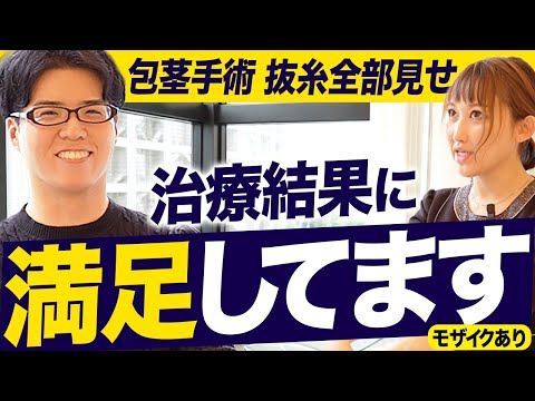 【手術見せ】包茎治療後2週間の抜糸と、患者のリアルな本音とは