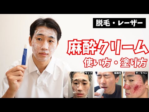 【使用歴5年】麻酔クリームの効果と顔への塗り方！おすすめはどれ？ラップは必要？