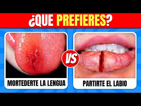 ¿Qué Prefieres…? Edición EXTREMA 😱⚠️ ¡LAS ELECCIONES MÁS DIFÍCILES!