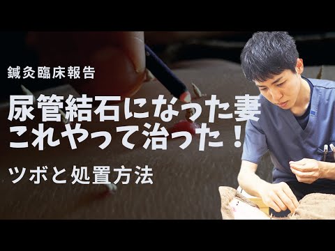 【尿管結石】妻にやったツボと処置方法（鍼灸臨床報告）｜練馬区大泉学園 お灸サロン仙灸堂