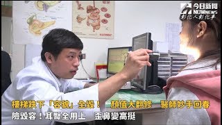 影／樓梯跌下「容貌」全毀！　顏值大翻修　醫師妙手回春