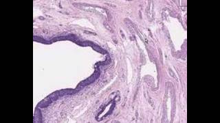 Shotgun Histology Male Urethra