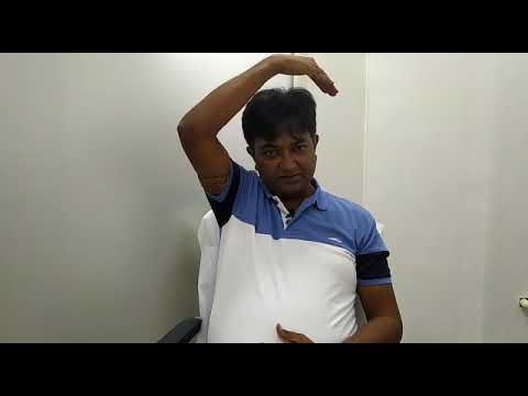 Patient testimonial l Frozen shoulder l Physiotherapy