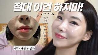 광고❌14년동안 피부과에서 했던 시술 총정리! 피부과 시술 추천 vs 절대 비추천 (얼굴형 관리,울쎄라,슈링크,리쥬란,인모드,올리지오,써마지,스킨보톡스)