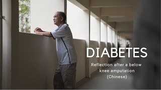 Diabetes: Reflection after a below knee amputation (Chinese)