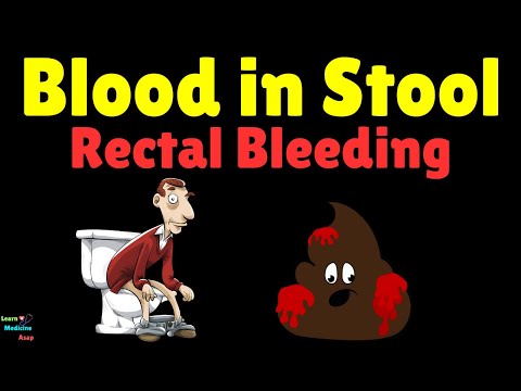 Blood in Stool – Causes, Symptoms, Diagnosis, Treatment & Prevention | Rectal Bleeding