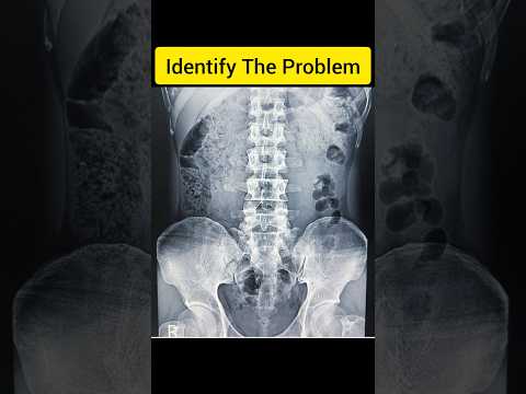 Identify the x ray problem