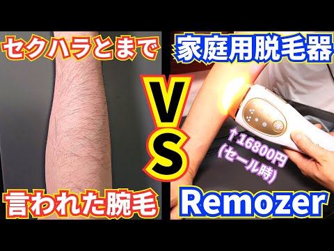 【ヒゲも抜ける？】セクハラとまで言われた腕毛 VS 光脱毛器Remozer 2 Pro【中年男性美容】