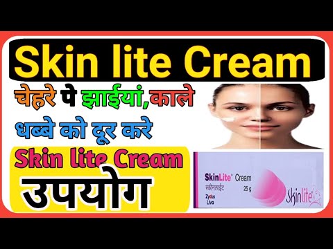 How to use skin lite Cream, What are the benefits of skin lite cream? #CNGAJBHIYE