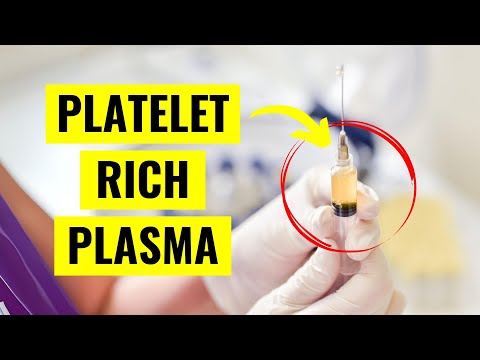 Platelet Rich Plasma (PRP) Injections: Everything You Need to Know