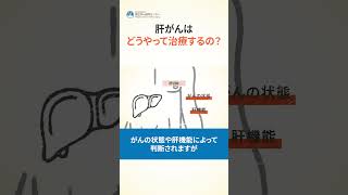 肝がんはどうやって治療するの？【手術】 #Shorts #解説