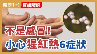 不是感冒  小心猩紅熱6症狀 | 健康1+1 · 直播精选