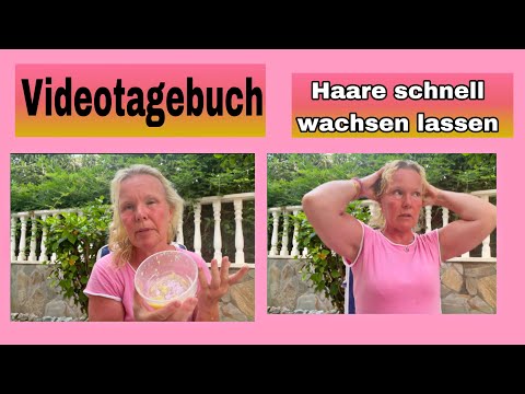 Videotagebuch Alopecia und Haarausfall bekämpfen mit Knoblauch, Zitrone, Olivenöl und Salz