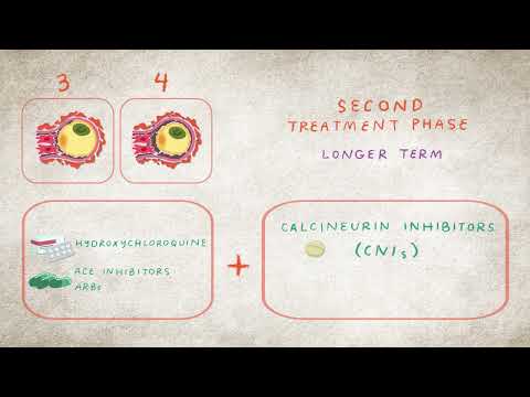 Nefritis Lúpica - Tratamientos | National Kidney Foundation