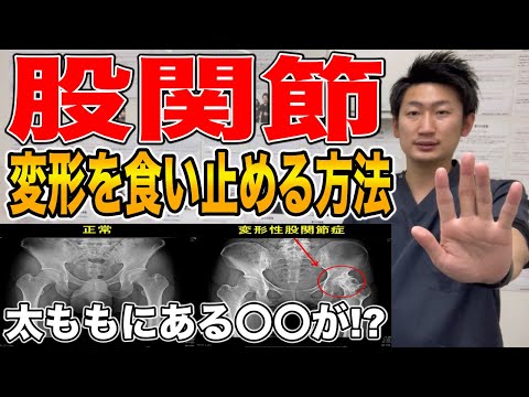 【知っておきたい】股関節の変形を食い止めるために必要な内容【#ハリボディTV】