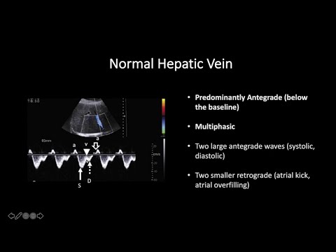 Doppler Ultrasound Part 2 - Spectral Waveforms from Head to Toe (Normal and Abnormal)