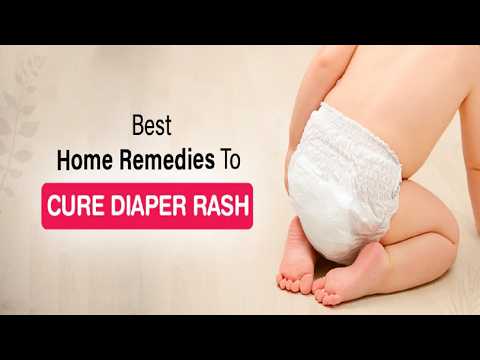 Home Remedies for Diaper Rash That Actually Work – Try These 5 Tips!