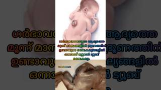 ഗർഭപാത്രത്തിലെ ആദ്യ മൂന്ന് മാസങ്ങളിലാണ് കുഞ്ഞിന് ഈ വൈകല്യം ഉണ്ടാവുക🤰#pregnancy #baby #shorts #short