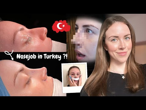 I Got a Nose Job in Istanbul | Turkey Rhinoplasty Vlog 2024