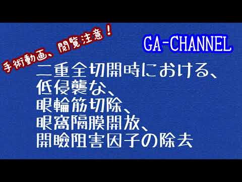 閲覧注意！二重全切開の手術動画です。