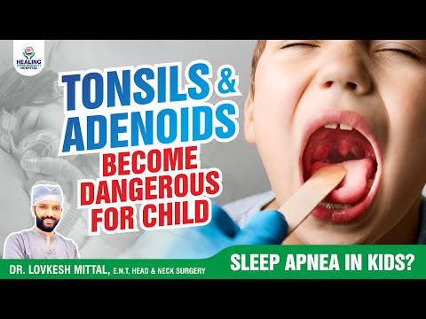 Tonsil & Adenoid Surgery in Kids: The Shocking Truth Parents Shouldn’t Ignore! | Healing Hospital