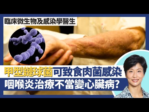 食肉菌感染：甲型鏈球菌｜甲型鏈球菌可致食人菌感染、白血病、猩紅熱！鏈球菌咽喉炎治療不當可致風濕性心臟病？常寄居於健康人士喉嚨及皮膚？｜臨床微生物及感染學醫生王建芳醫生｜人類健康研究所