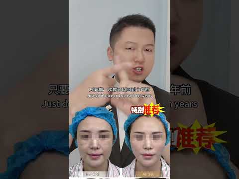 女人只要过了35岁，就没必要做线雕，也不需要打玻尿酸，虽然刚做完效果不错，但是六个月之后又会打回原形，真的很浪费钱浪费时间。而LEO团队的3D提拉，只做一次就可以回到十年前，自然紧致，水嫩饱满