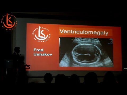 Fetal Neurosonography Course by London School of Ultrasound 2019