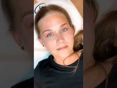 eye Brow treatment