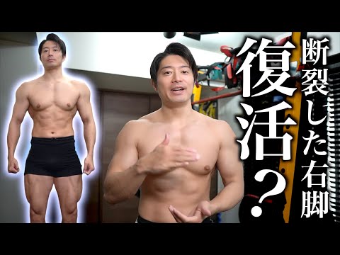 脚治ってきたぜぇ！筋肉も戻ってきたのでは!?