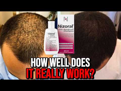 Ketoconazole Shampoo for Hair Growth - How Well Does it REALLY Work?